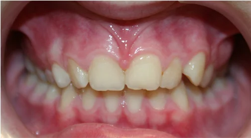 before Image