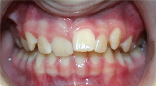 before Image