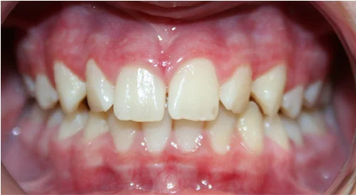 before Image