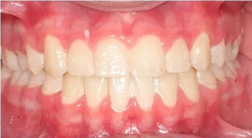 after Image
